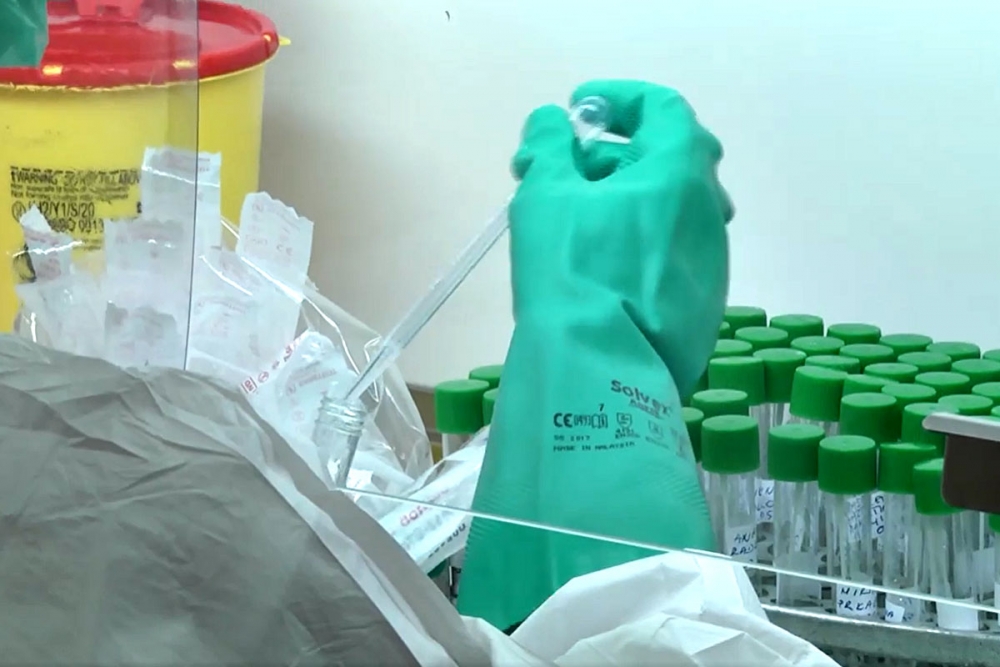 Danas u županiji 54 nova slučaja zaraze - četiri iz Župe dubrovačke, hospitalizirano 17 oboljelih